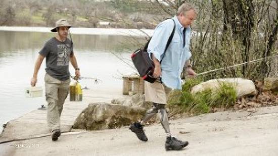 Proteza complecta, membru inferior drept "GENIUM - BIONIC PROSTHETIC SYSTEM"