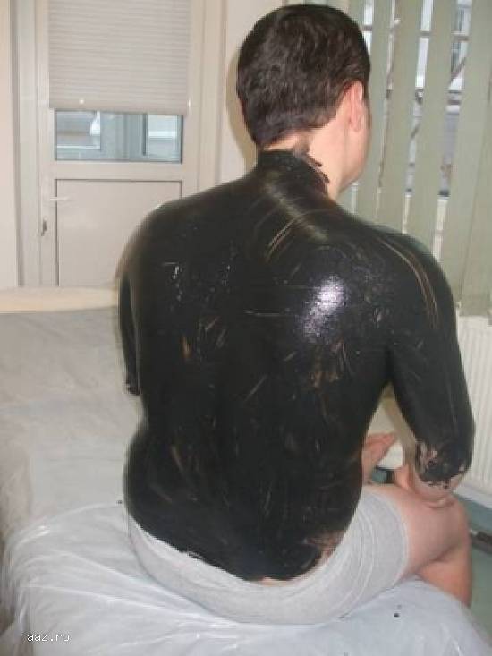 Nămol sapropelic terapeutic