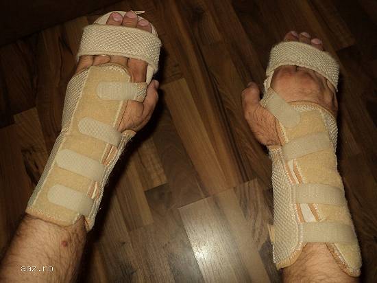 orteza medicala orteze fixe,  mobile diverse modele