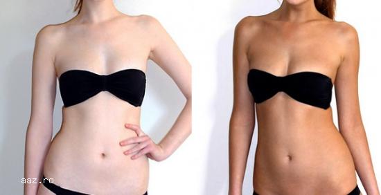 Bronz Organic la doar 80 lei in Oradea