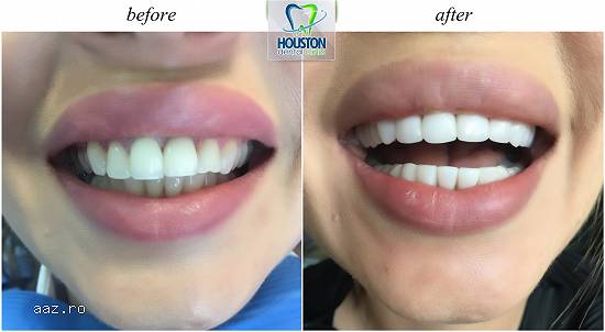 Dentist copii dr. Rares Bercea