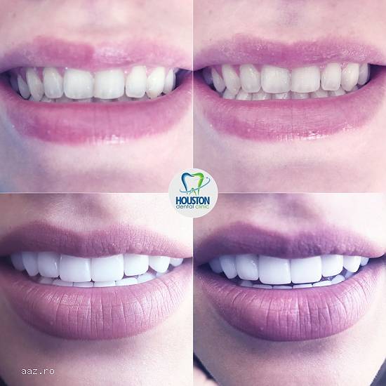 Dentist copii dr. Rares Bercea