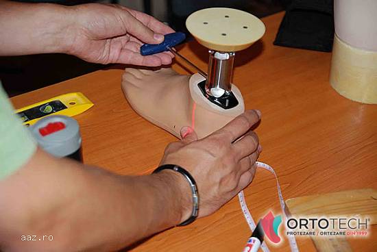 ORTOTECH produse si servicii de tehnica ortopedica,    ortezare si protezare