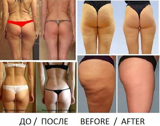 Aparat Darsonval - cosmetologul tau personal...