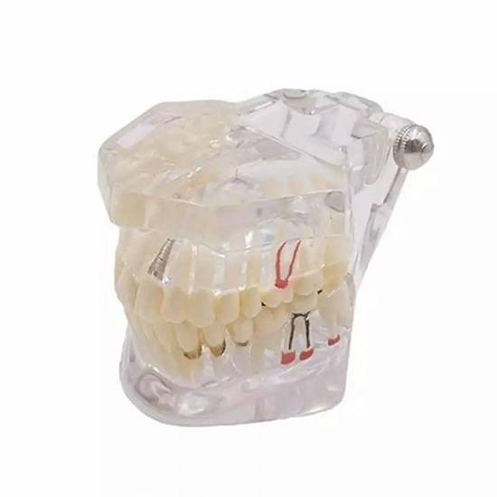 Model dentar Macheta dentara Dinti artificiali stomatologie