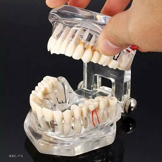 Model dentar Macheta dentara Dinti artificiali stomatologie