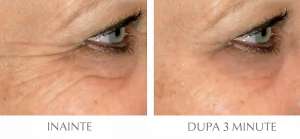 Epilift Instant Face Lift Serum