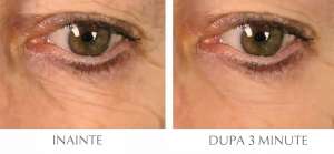 Epilift Instant Face Lift Serum